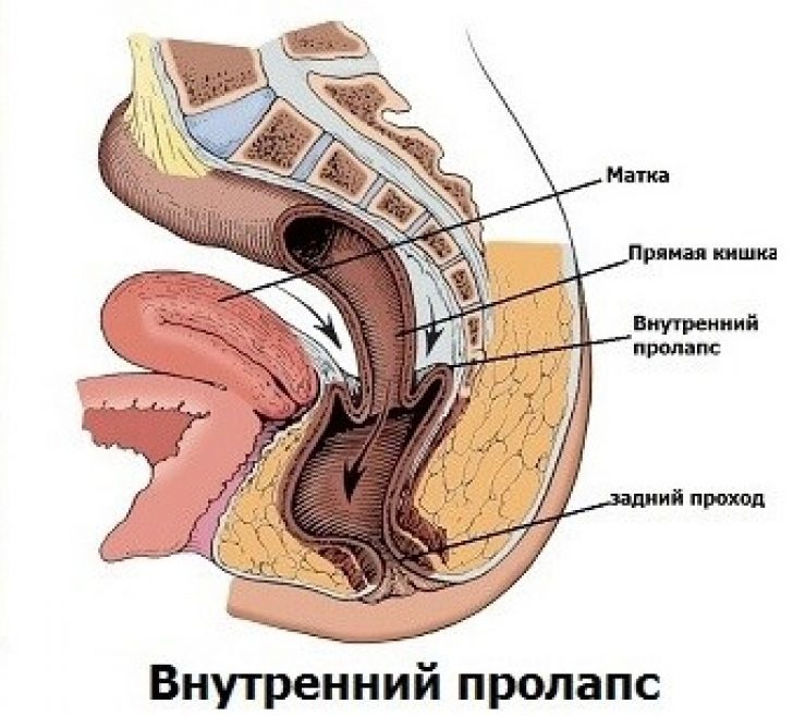 Анальный Секс Максимально Возможный Размер