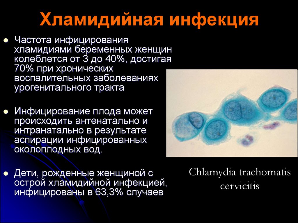 Порно Видео Онлайн Трансексуалка Бэйли Джей