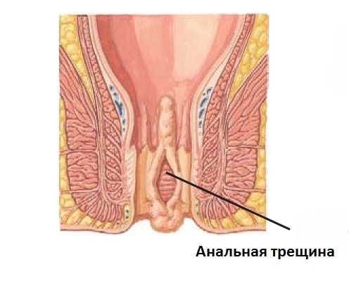 Канал Порно Зуд Тв