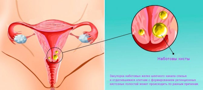 Белые Наросты Во Влагалище