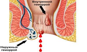 Порно Войны Эпизод 1скачать