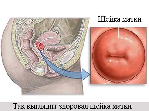 Смотреть Порно С Ранетками