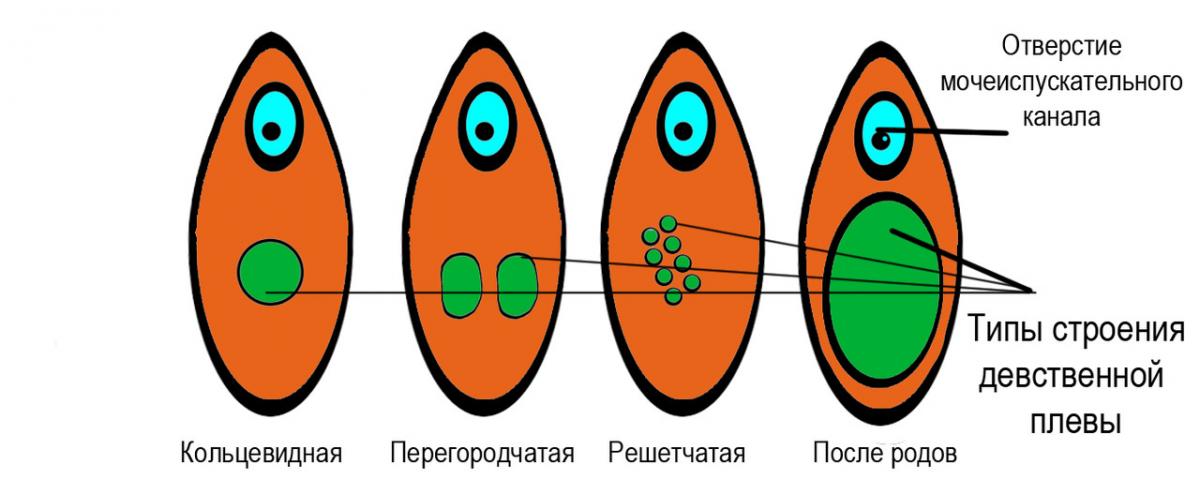 Как Выглядит Девственная Вагина