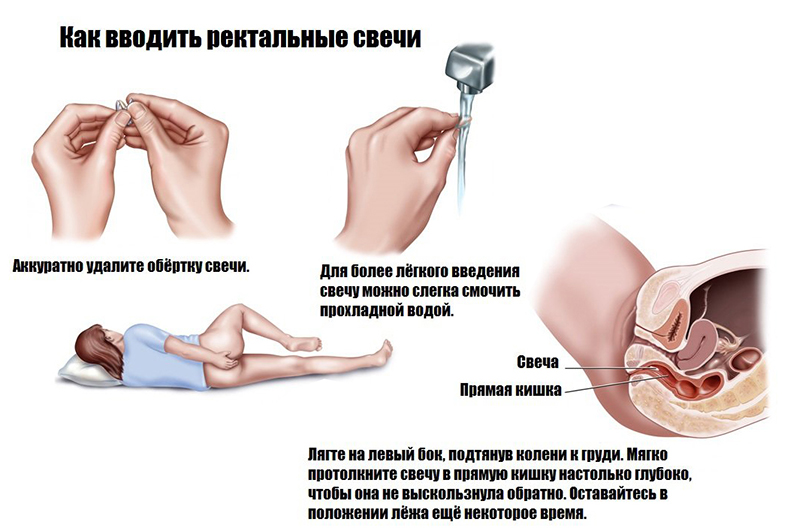 Прозрачные Трусики Просвечивают Лобок