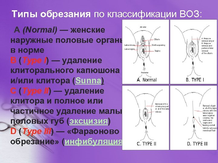 Обрезанный Клитор