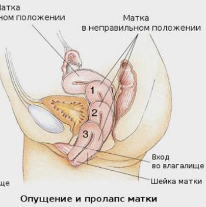 Порно Разорваная Пизда