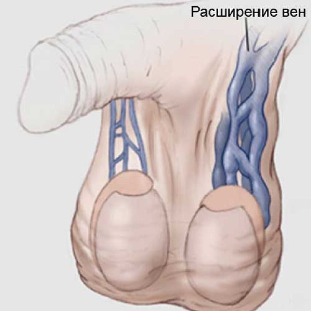 Фото Мултки Порно Блум