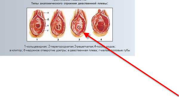 Дефлорация Отверткой Онлайн