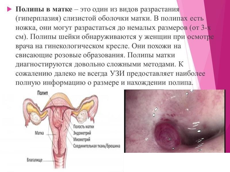 Покалывание Во Влагалище При Беременности