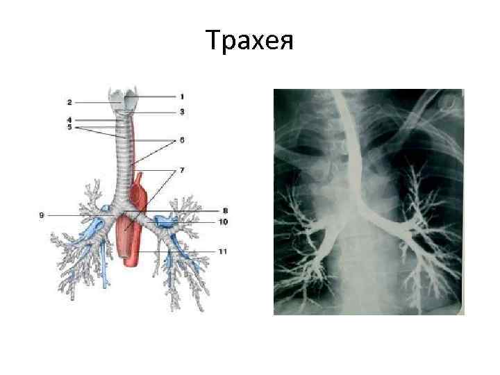 Саднит В Трахее