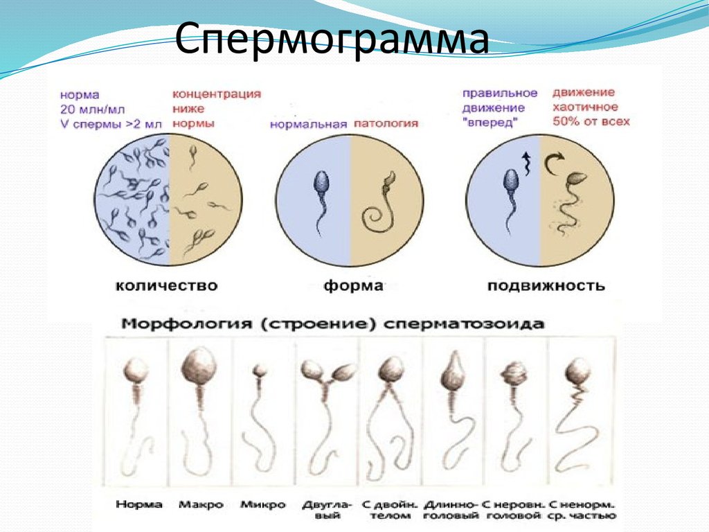 Морфология Сперм