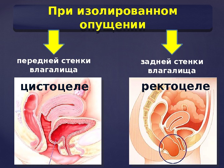 Болят Стенки Влагалища При Беременности