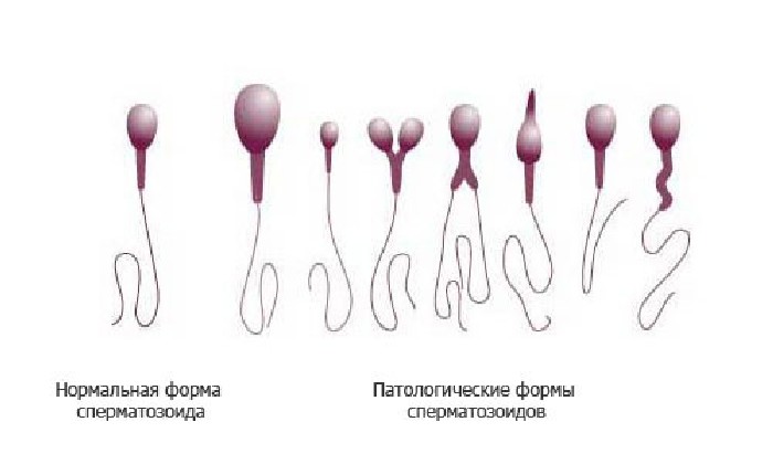 Порно Но Закрытое Листиком