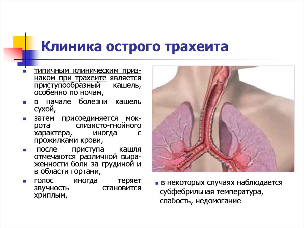 Саднит В Трахее