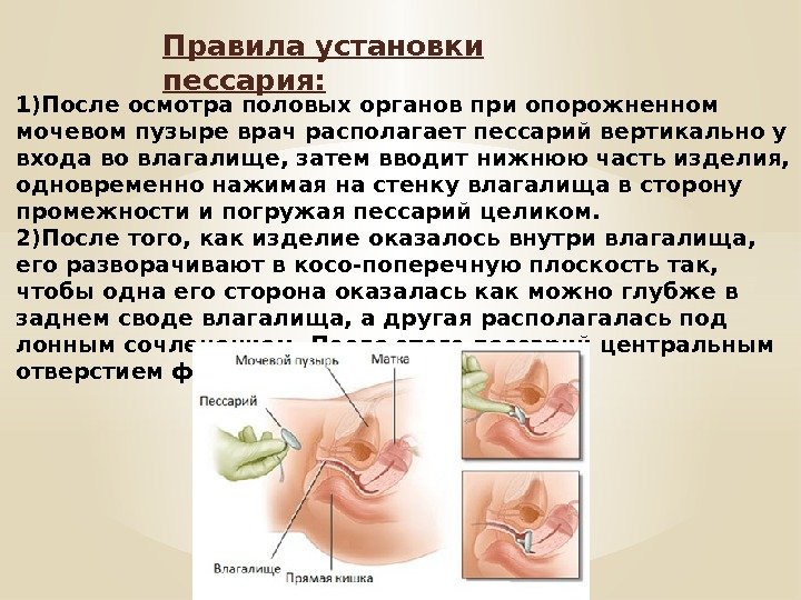 Стреляет Во Влагалище При Беременности