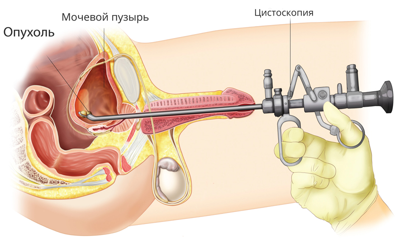 Член Застрял В Вагине