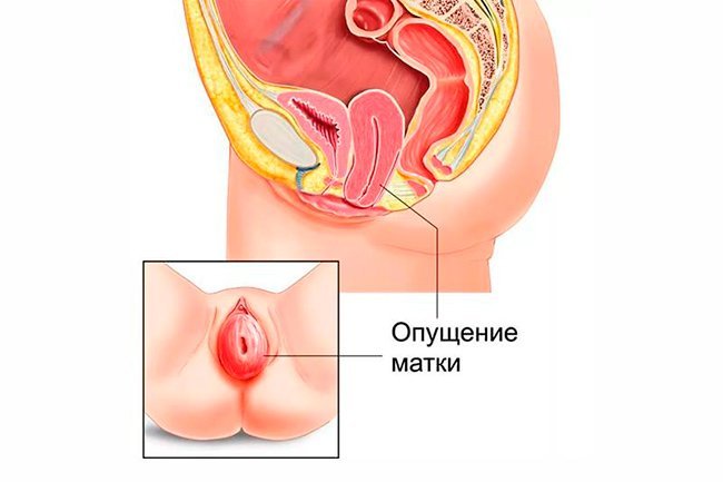 Алика Смехова Эротичная