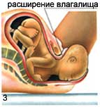 После Секса Болит Вагина