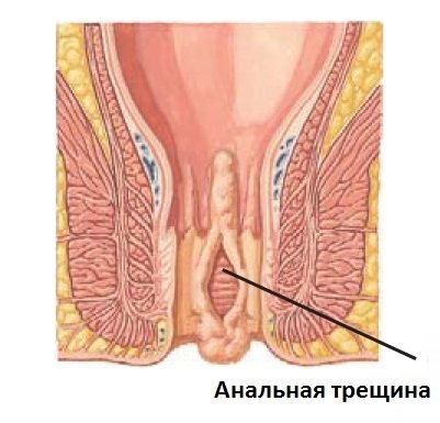 Николай Пальцем Нашел Анальное Отверстие И Начал Поглаживать Его