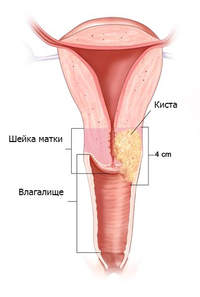 Как Расширить Вход Во Влагалище