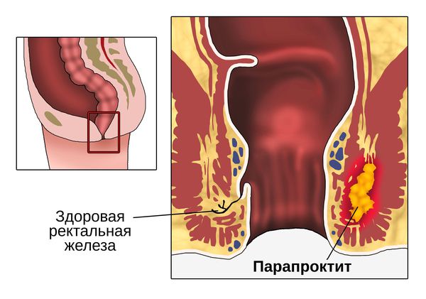 Скачать Короткометражное Порно Через Торрент