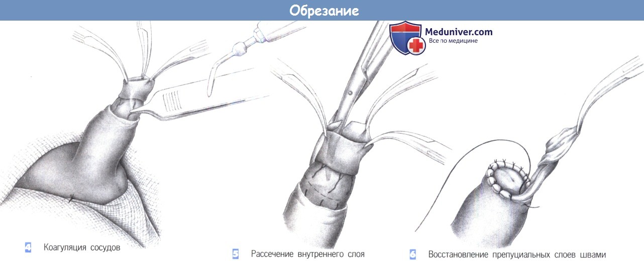 Секс Видео Мультики Аватар Корры