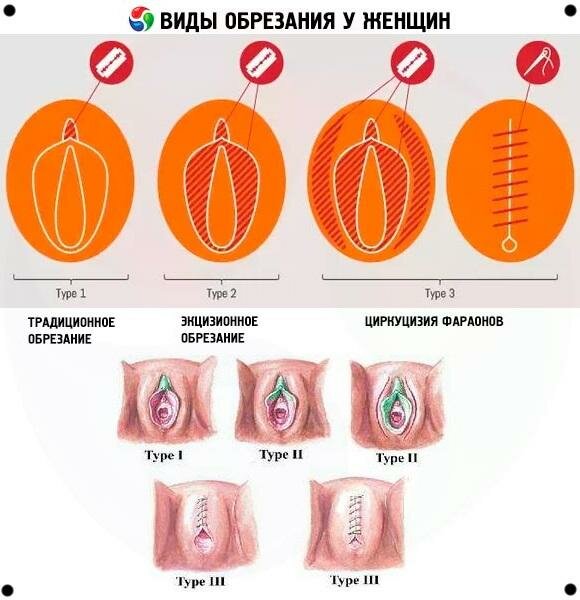 Мультики Кит Виси Кэт Порно