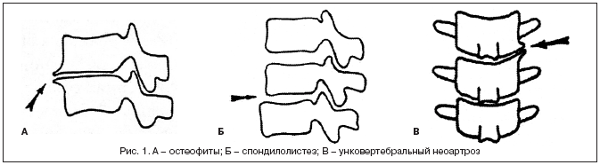 Порно Фильм Сельские Каникулы Смотреть