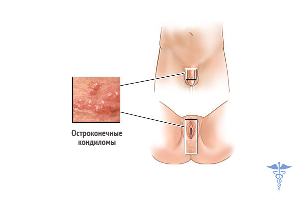 Мила Кунис Порно