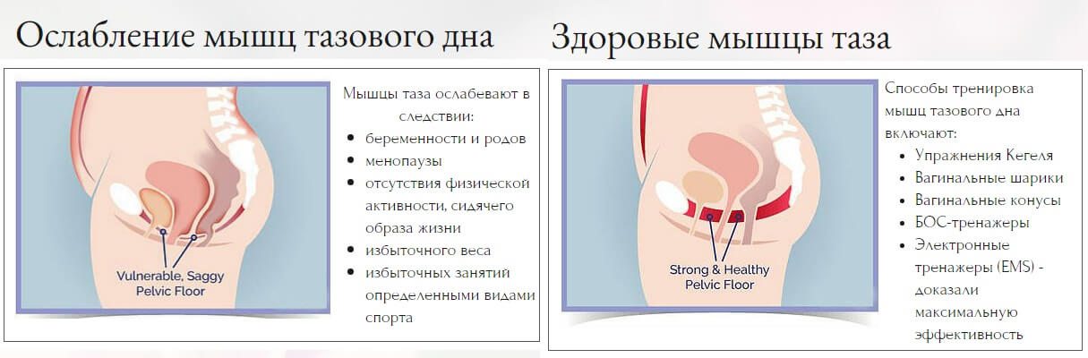 Гинекологический Осмотр Девственниц