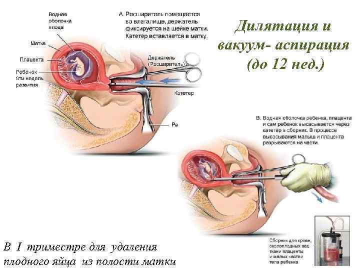 Бисекс В Армии