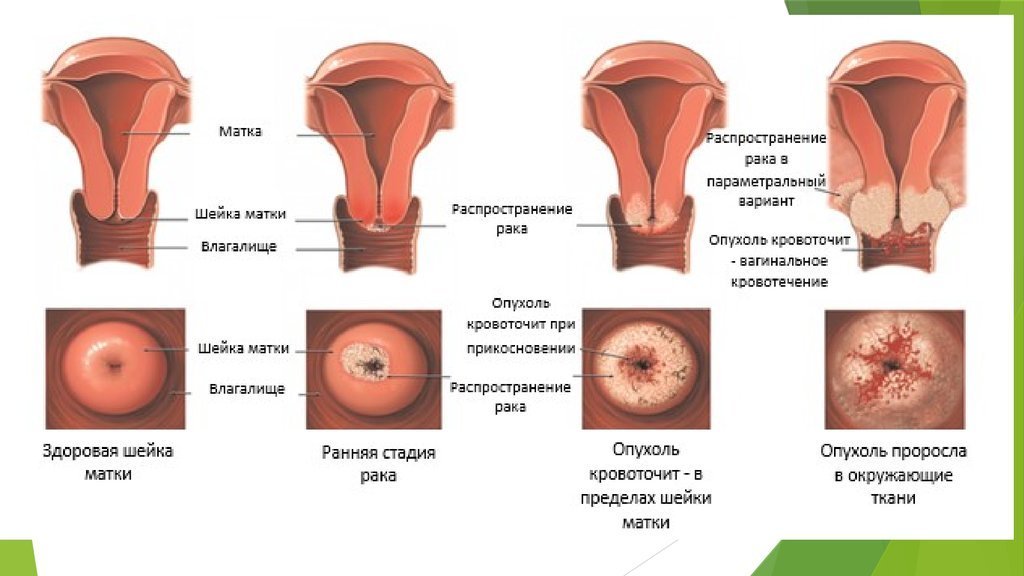 Распухло Влагалище