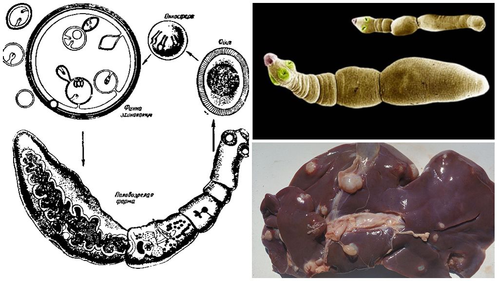 Первый Членик Эхинококка Называется