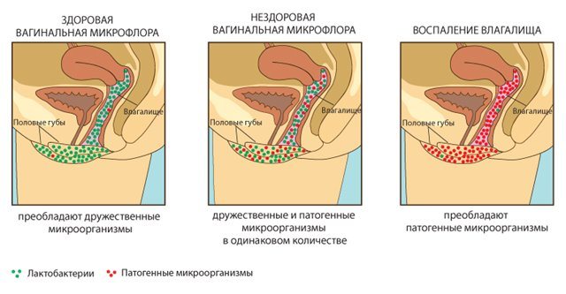Флора Влагалища Кокки