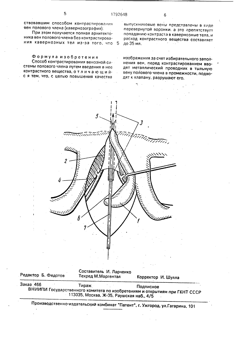 Тыльная Вена Полового Члена