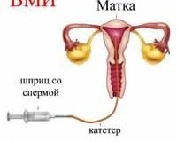 Порно Фото Апиной