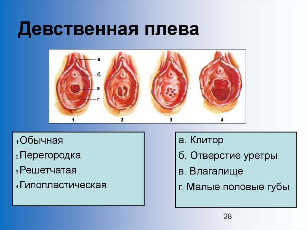 Лишение Дественности Онлайн