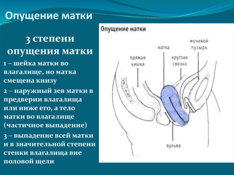 Кристи Мак И Капри Порно