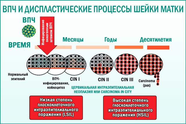 Впч Оральный Секс