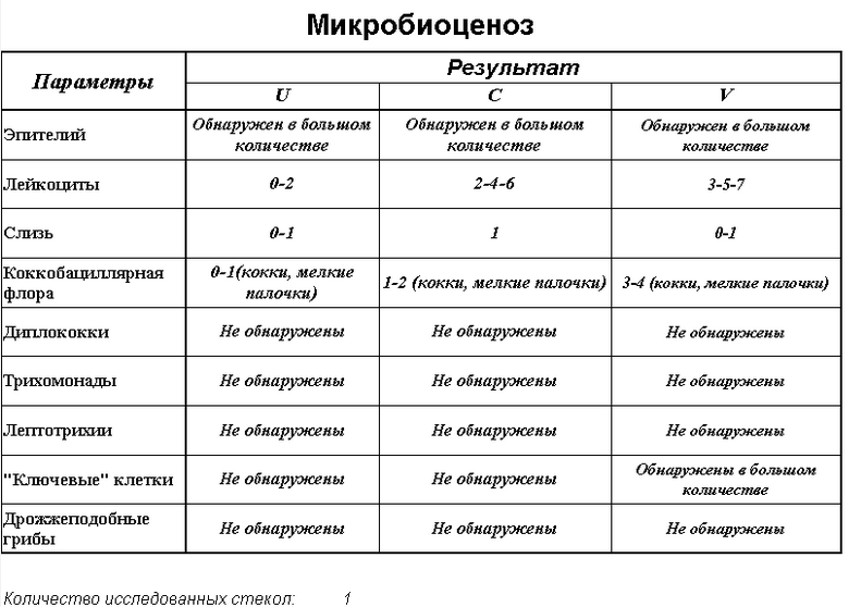 Порно С Алой Пугачовой