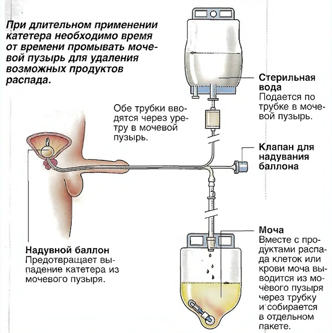 Катя Самбука Силиконовые Сиськи