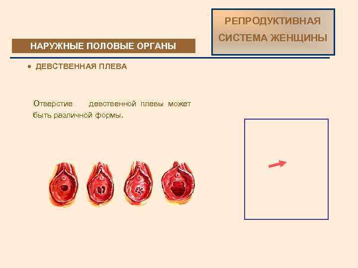 Есть Ли В Ланосе Целка