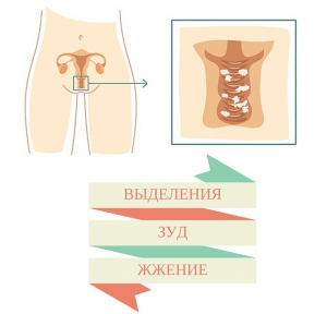 Жжение При Входе Во Влагалище