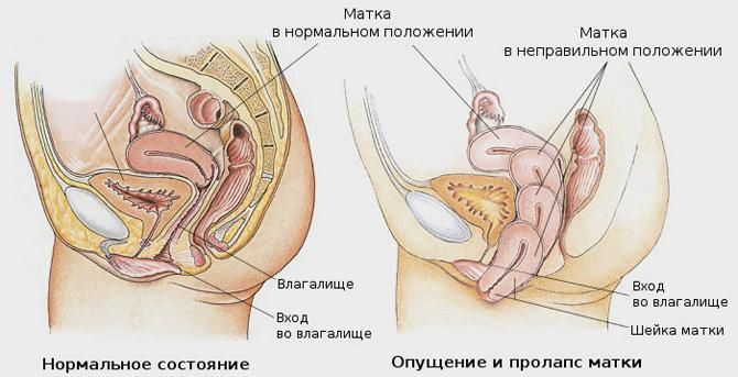 Техникой Сжимания Влагалища