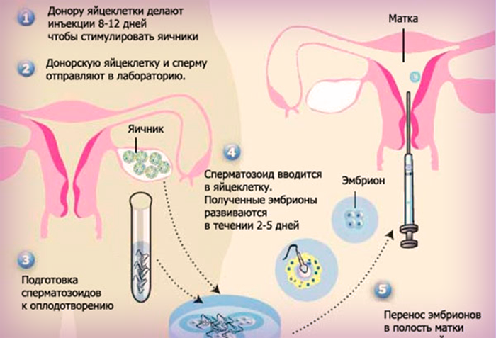 Спермограмма Оральная Стимуляция