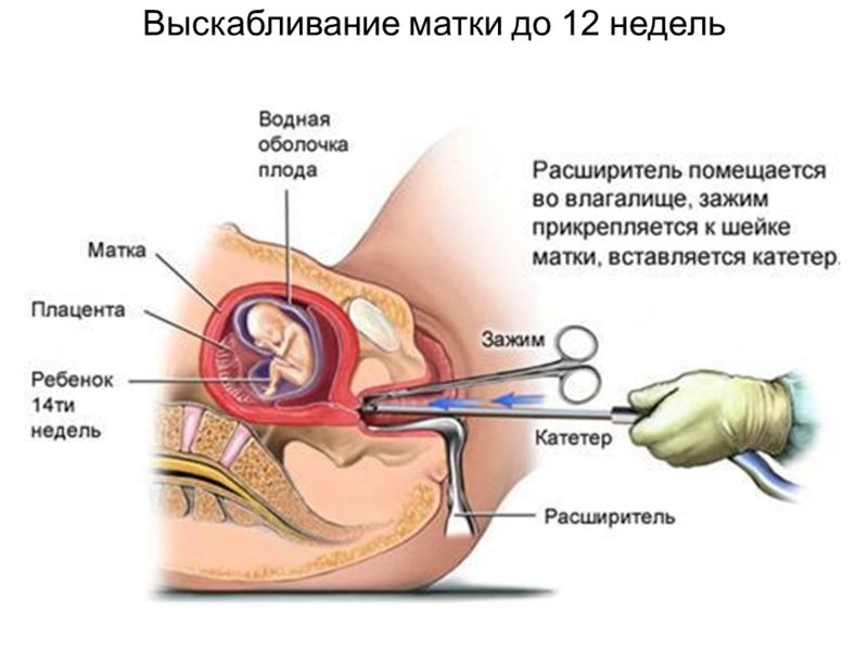 Отличие Трансвестит От Транссексуал