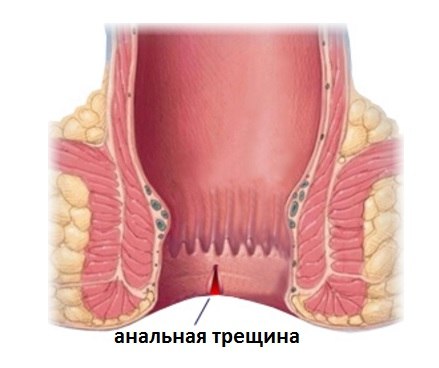 Анальный Сфиктер Плотно Сжал Член