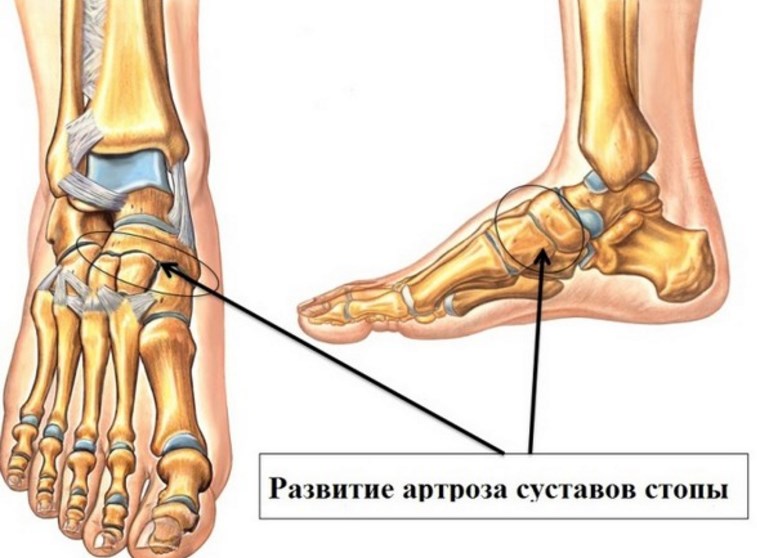 Время Приключений Порнушка