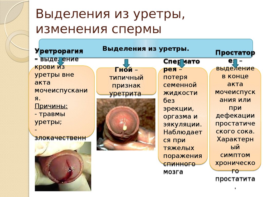 Сперма Ее Состав И Густота