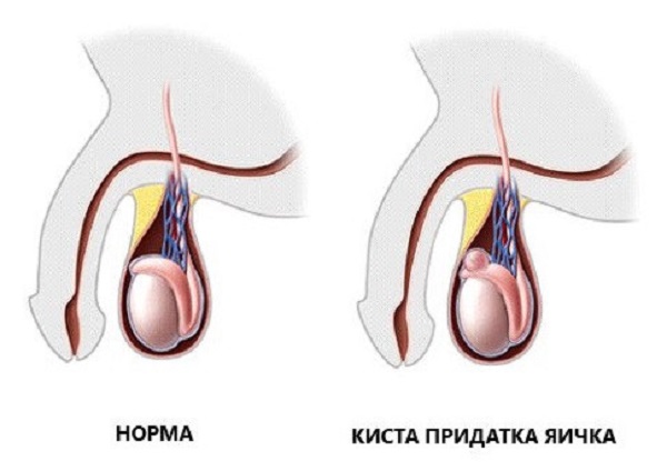 Порно Ольга Рыжая И Вонючая